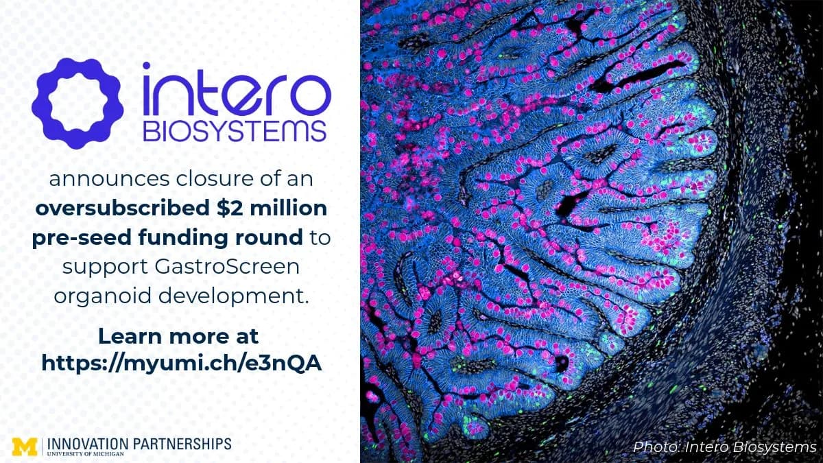 Снимка към „Intero Biosystems предлага миниатюрни човешки черва за тестване на лекарства“