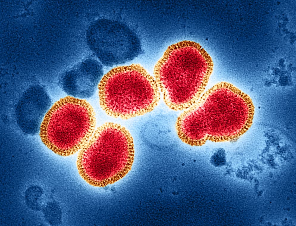 Снимка към „Потвърден е първият грипен вирус A(H3N2) за сезон 2026/2027 у нас“